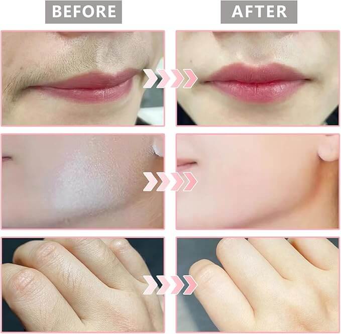 Hair Identifier Spray for Dermaplaning – Includes 4 Face Razors